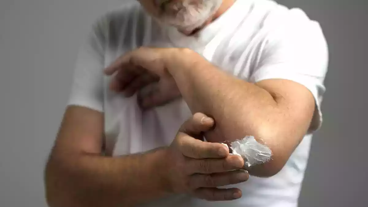 Tereyağının küçük yanıkları yatıştırdığı doğru mu?
