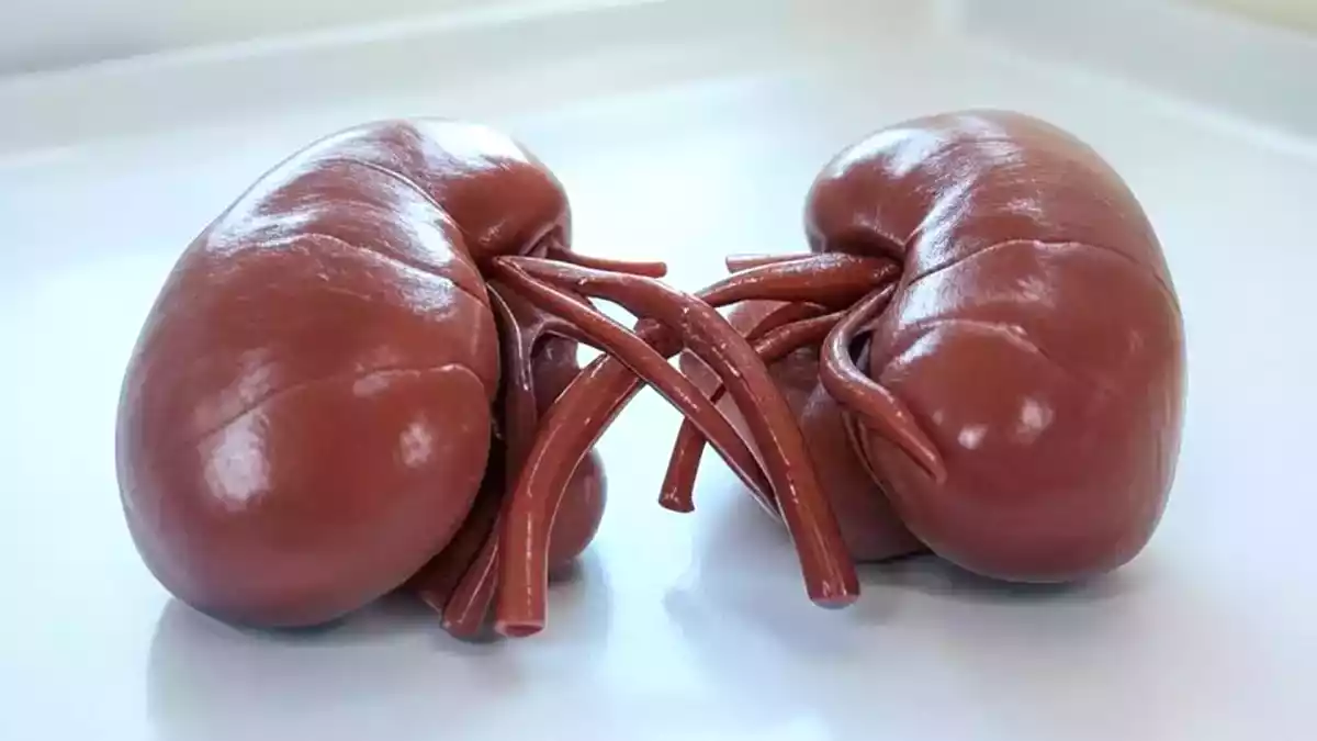 Ciddi böbrek sorunlarını önlemek için 7 ipucu. Sağlığınızı korumak için bunları şimdi öğrenin!
